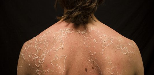 רוצים עור בריא?