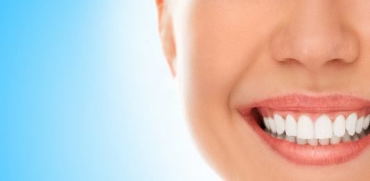 ציפוי שיניים בתל אביב