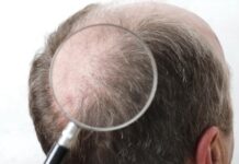 כל מה שצריך לדעת על טיפולים קוסמטיים לשיער ולגבות