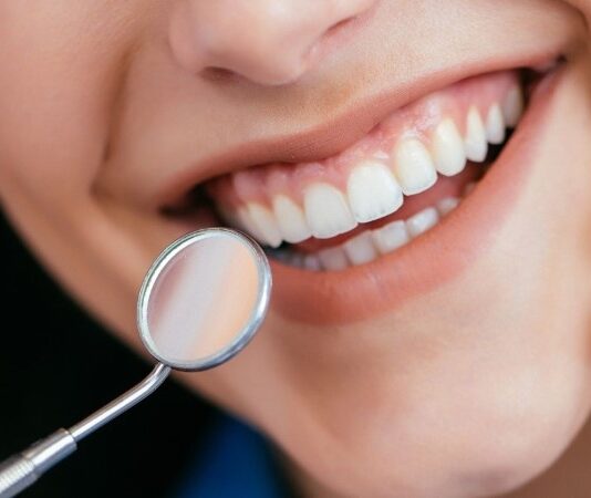 גשר שקוף – הפתרון האסתטי לשיניים חסרות שאתם לא מכירים